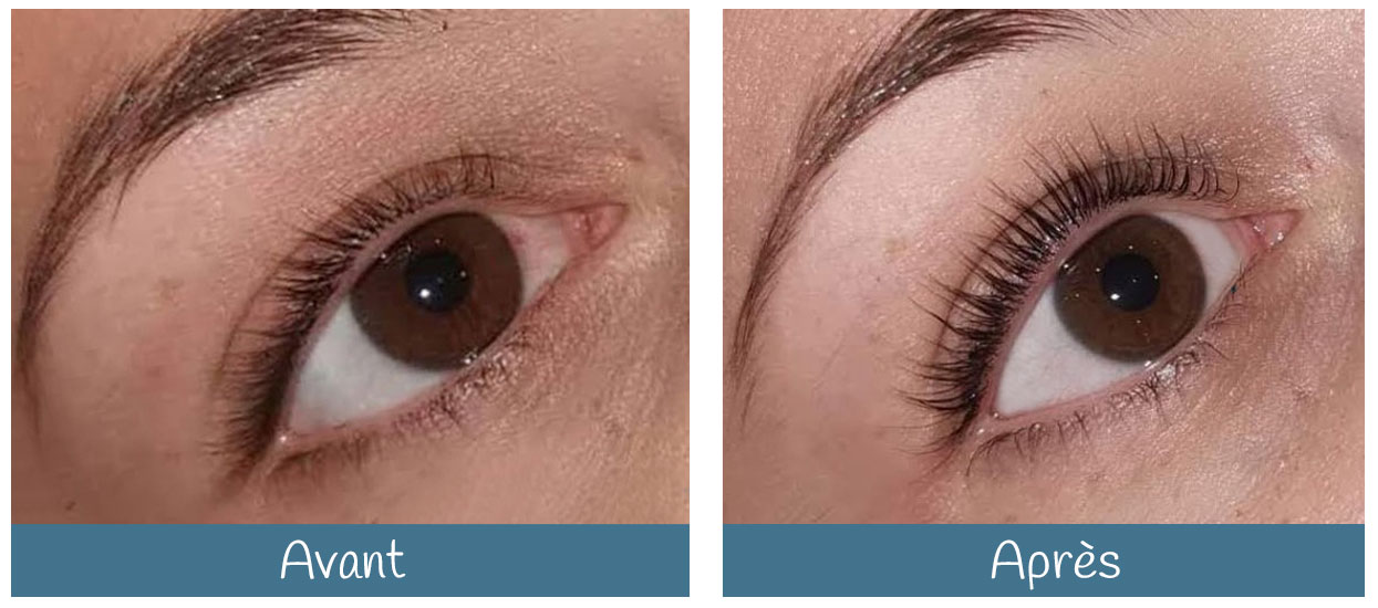 Rehaussement de cils Lash Lift • Centre de Santé Danielle